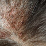 Raico weer een aanval van allergie, ondanks alles weer aan de…