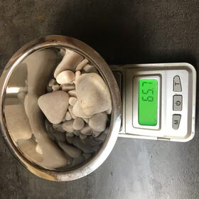 De verwijderde stenen. De grootste steen woog meer dan 25 gr.